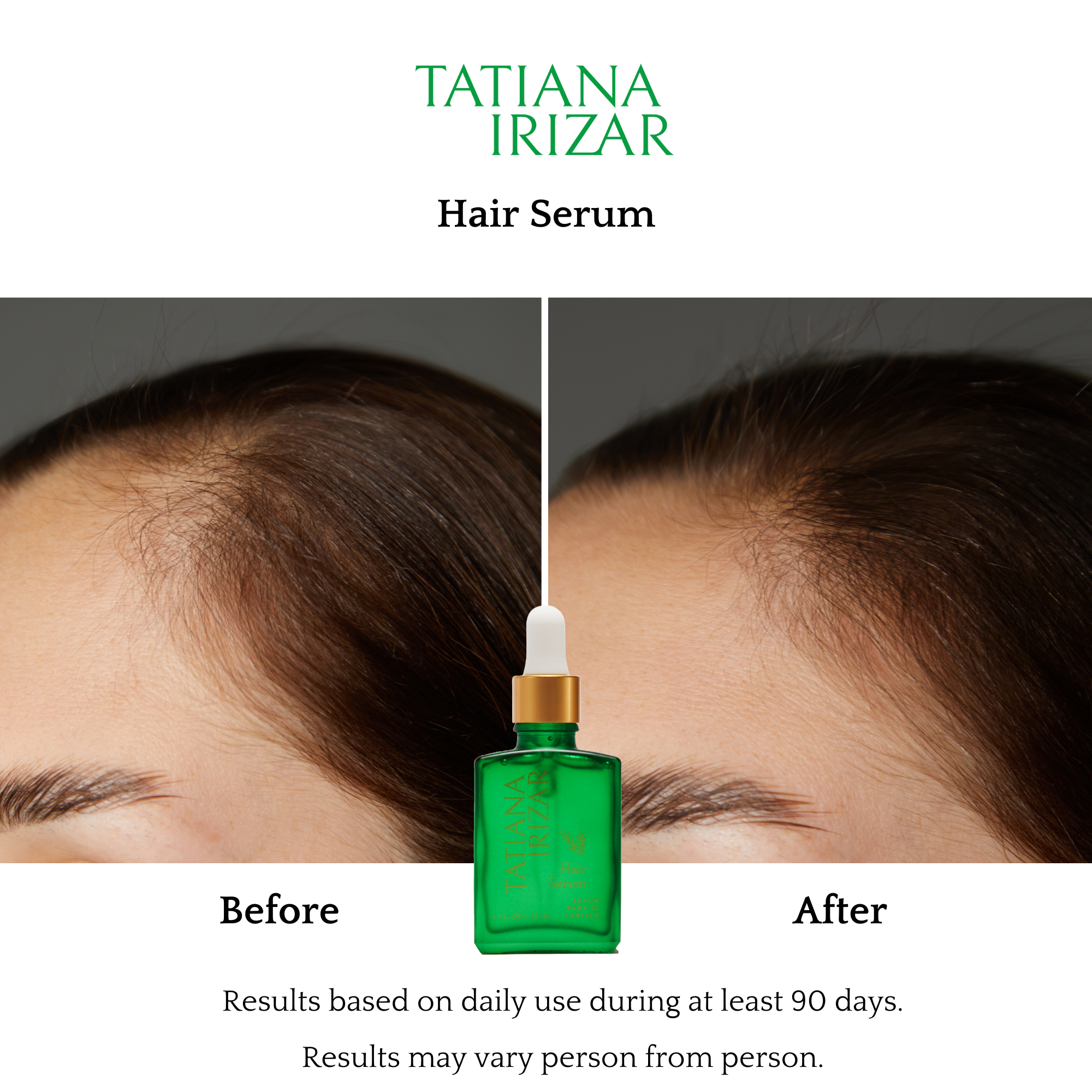 Tatiana Irizar Hair Serum Results